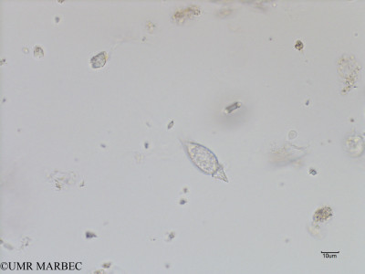 phyto/Bizerte/bizerte_bay/RISCO July 2016/Oxytoxum parvum (Baie_T1B-oxytoxum parvum-3 -1).tif(copy)_thumb.jpg